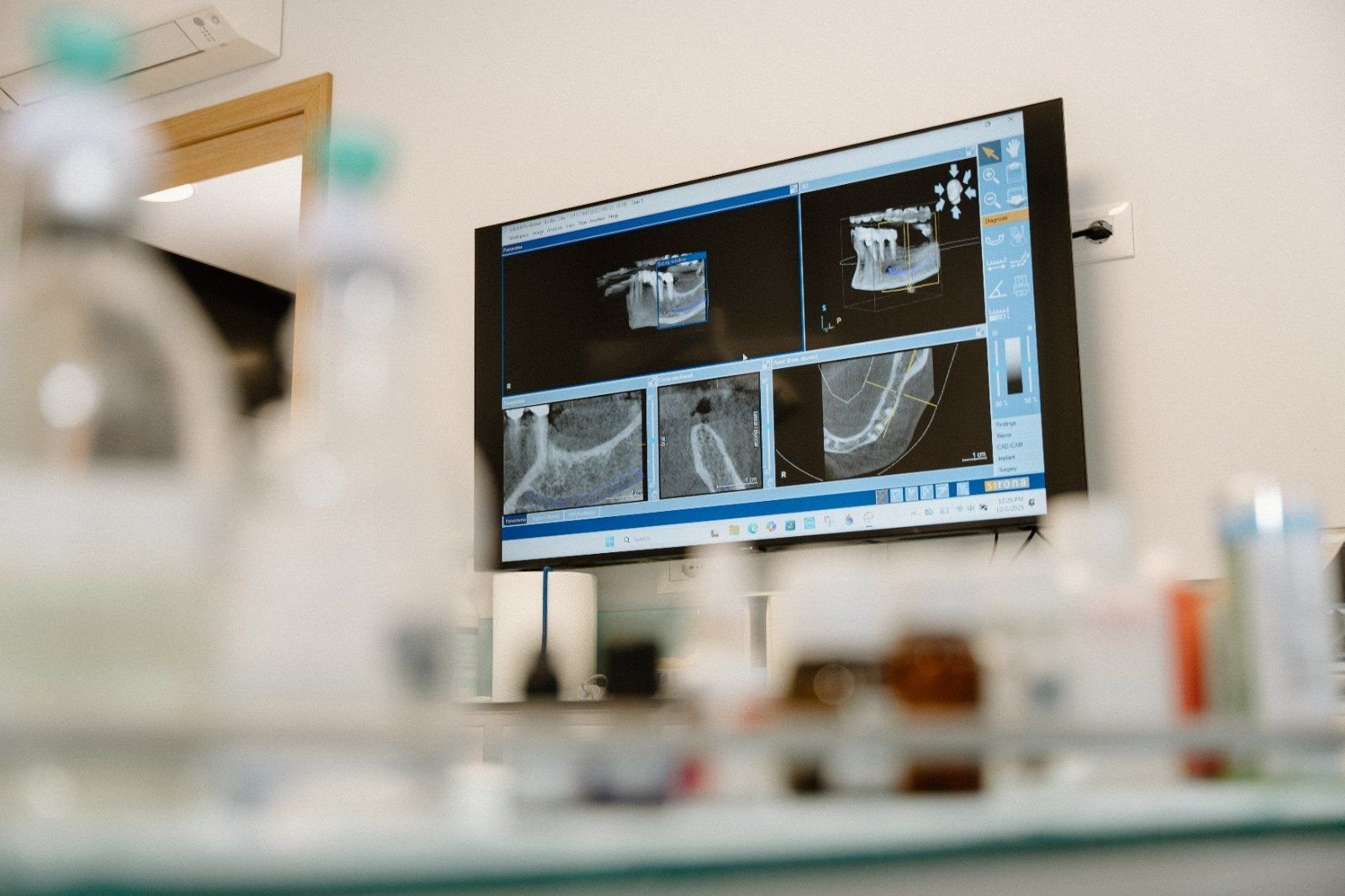 Imagen CBCT 3D en pantalla